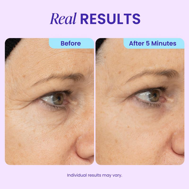 Warehouse Clearout Instant Lifting Under Eye Gel, Targets Puffy Eyes, Dark Circles & Fine Lines, Collagen Anti-Aging Brightening Eye Care for All Genders