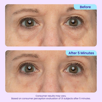 Warehouse Clearout Instant Lifting Under Eye Gel, Targets Puffy Eyes, Dark Circles & Fine Lines, Collagen Anti-Aging Brightening Eye Care for All Genders