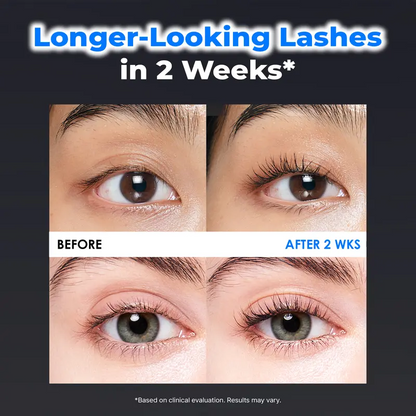 Eyelash Growth Serum- Safe & Gentle Lashes Care, Fuller, Thicker in 2 Weeks, Non-Prostaglandin